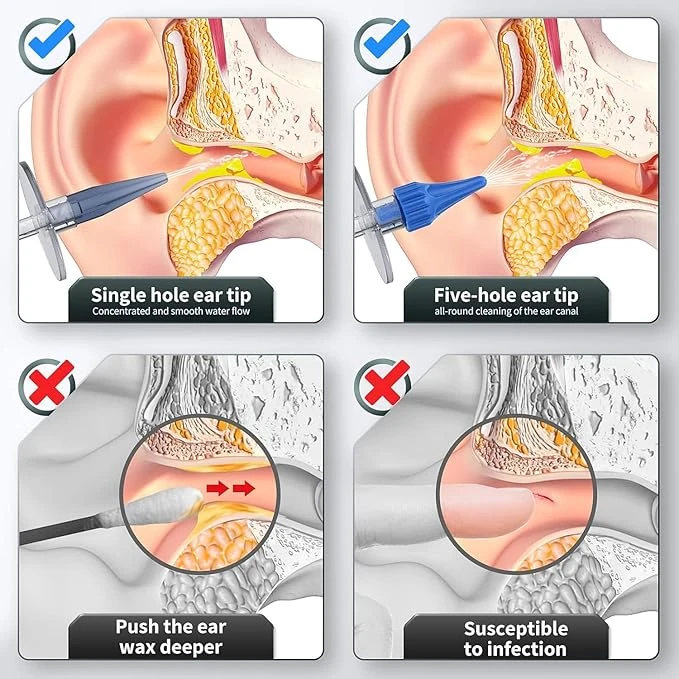 Ear Wax Removal Kit
