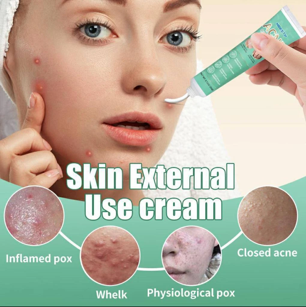 HBESTY ACNE REMOVER CREAM