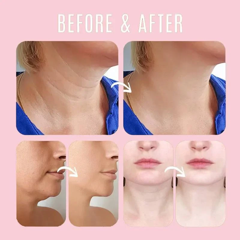 WEST&MONTH PROBIOTIC SKINCARE - FINE LINES DIMINISHING & ROSE HIP EYE BALM