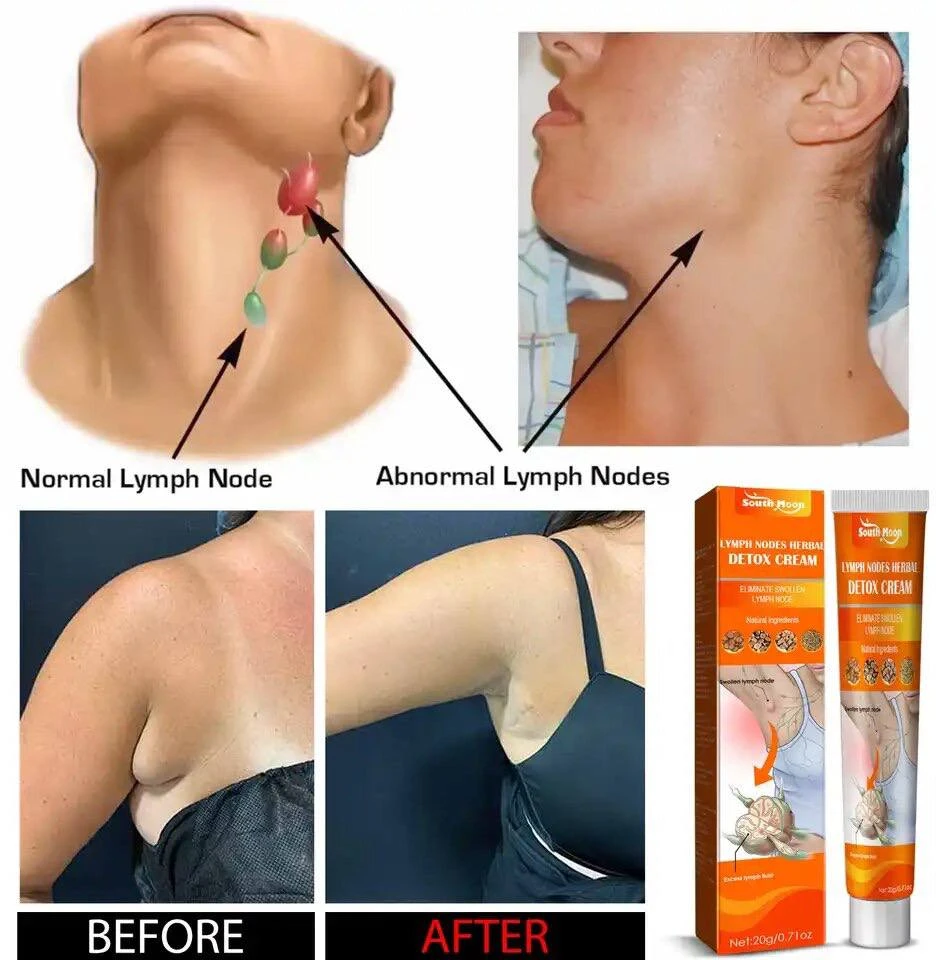 SOUTH MOON LYMPH NODES HERBAL DETOX CREAM - MASSAGE & ANTI SWELLING HERBS CREAM