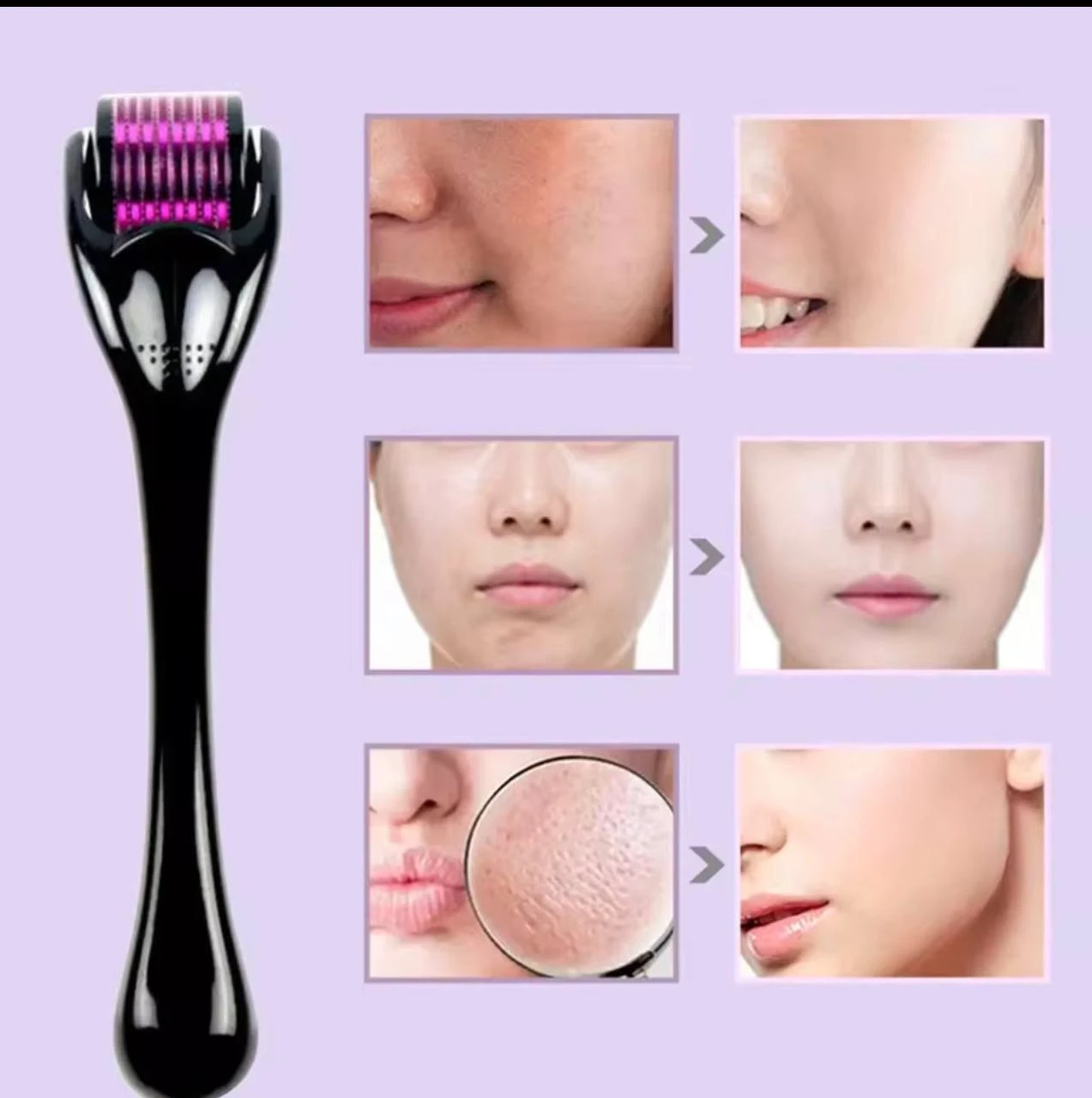 DERMA ROLLER – PROFESSIONAL MICRONEEDLING HAIR / SKIN CARE TOOL